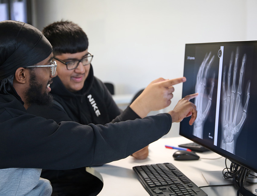 Two students looking at an X Ray of a hand